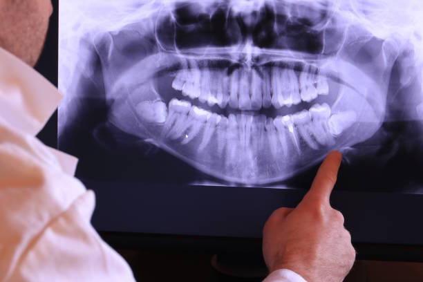 Best Broken or Cracked Tooth Emergency Dentist in Central City, IA